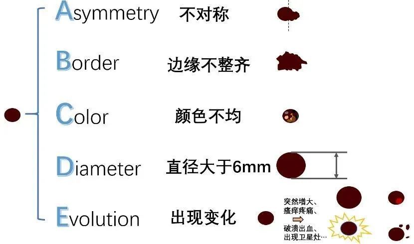 医生 我这颗痣要紧么?