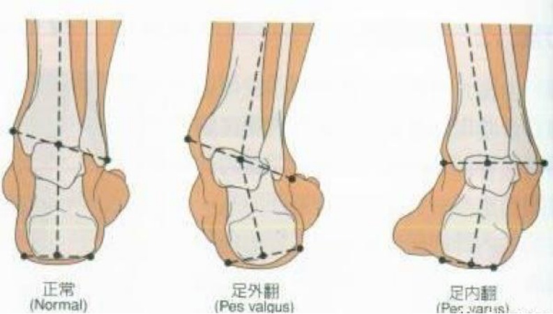 经常跑步的你 这些注意事项你都知道吗 看这里