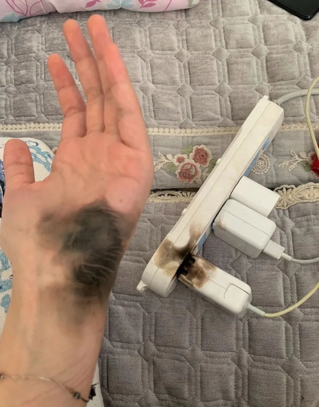 女子带手链拔插头突发爆炸,手掌当场熏黑!