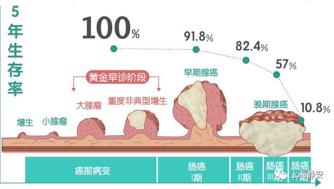 可以精准解读粪便中基因异常改变  它可以帮助医生早期发现患者的肠癌