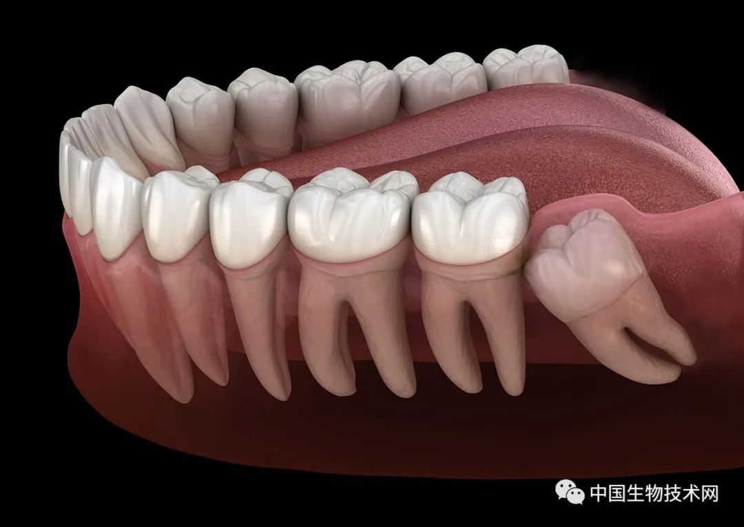 【有益思】science子刊:原来,人类迟迟不长出智齿是为了安全