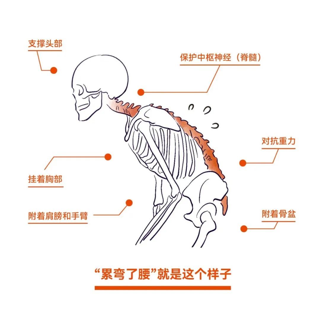 (繪圖:wtx) 在腰椎變直的狀態下,椎間盤承受了更大的壓力,後面的小