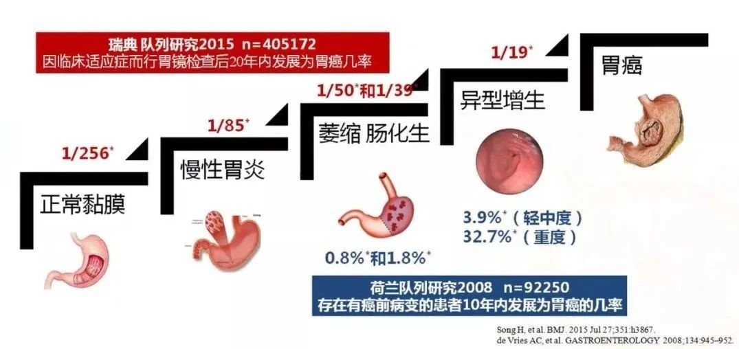 胃癌为什么叫幸运癌图片