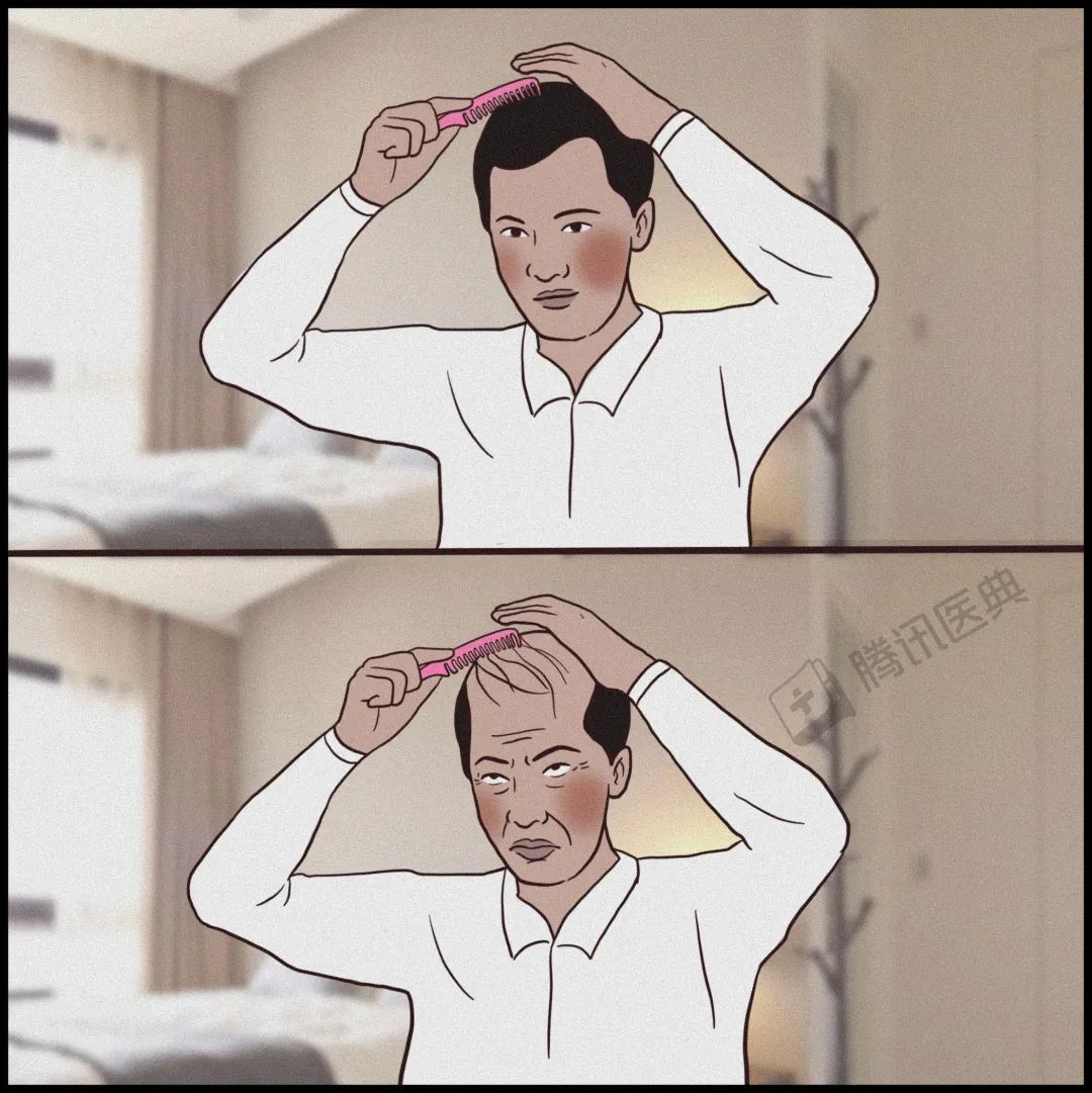 激光疗法有什么作用一篇帮人类打败脱发的文章（转给身边的他和她）_https://www.jmylbn.com_新闻资讯_第15张