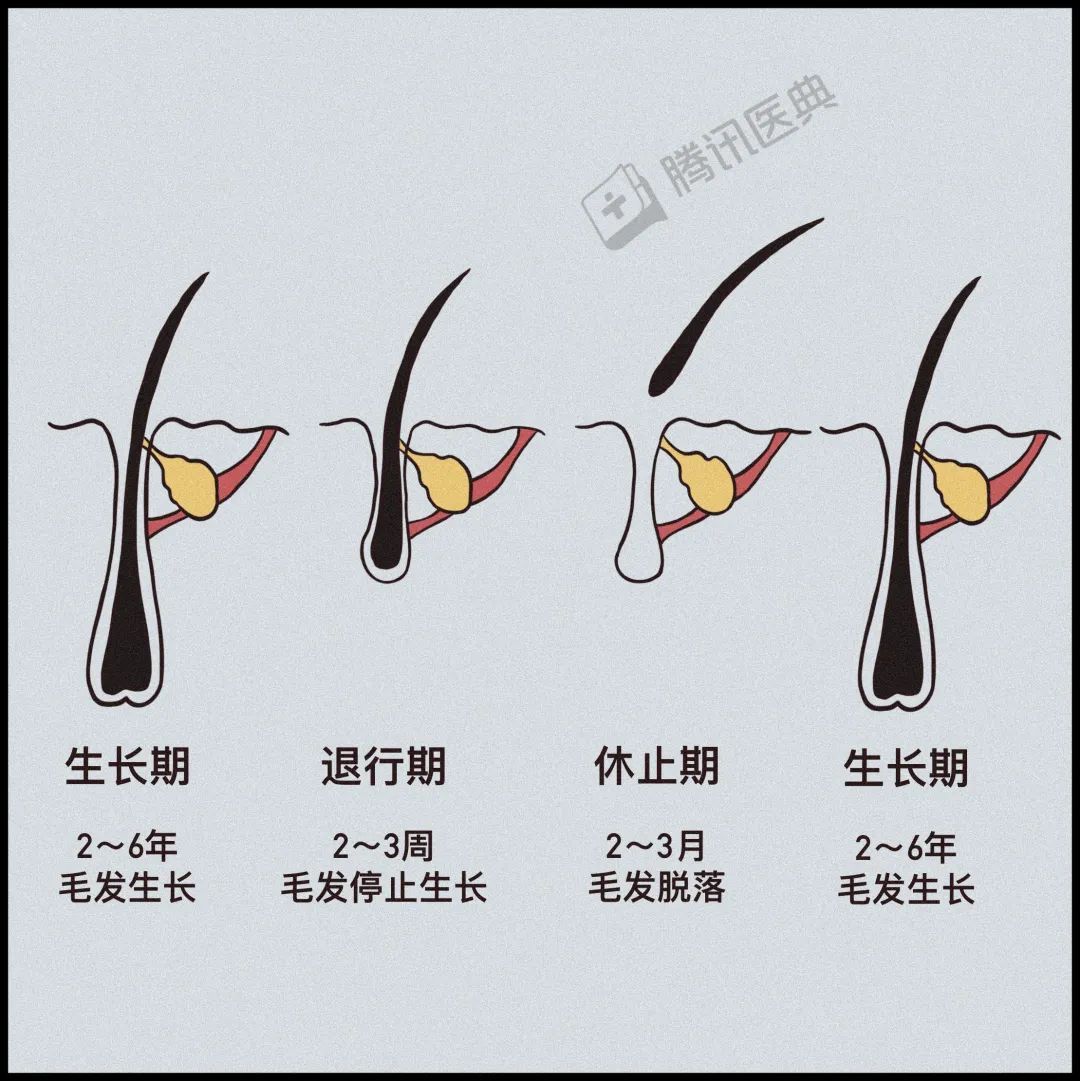 激光疗法有什么作用一篇帮人类打败脱发的文章（转给身边的他和她）_https://www.jmylbn.com_新闻资讯_第12张