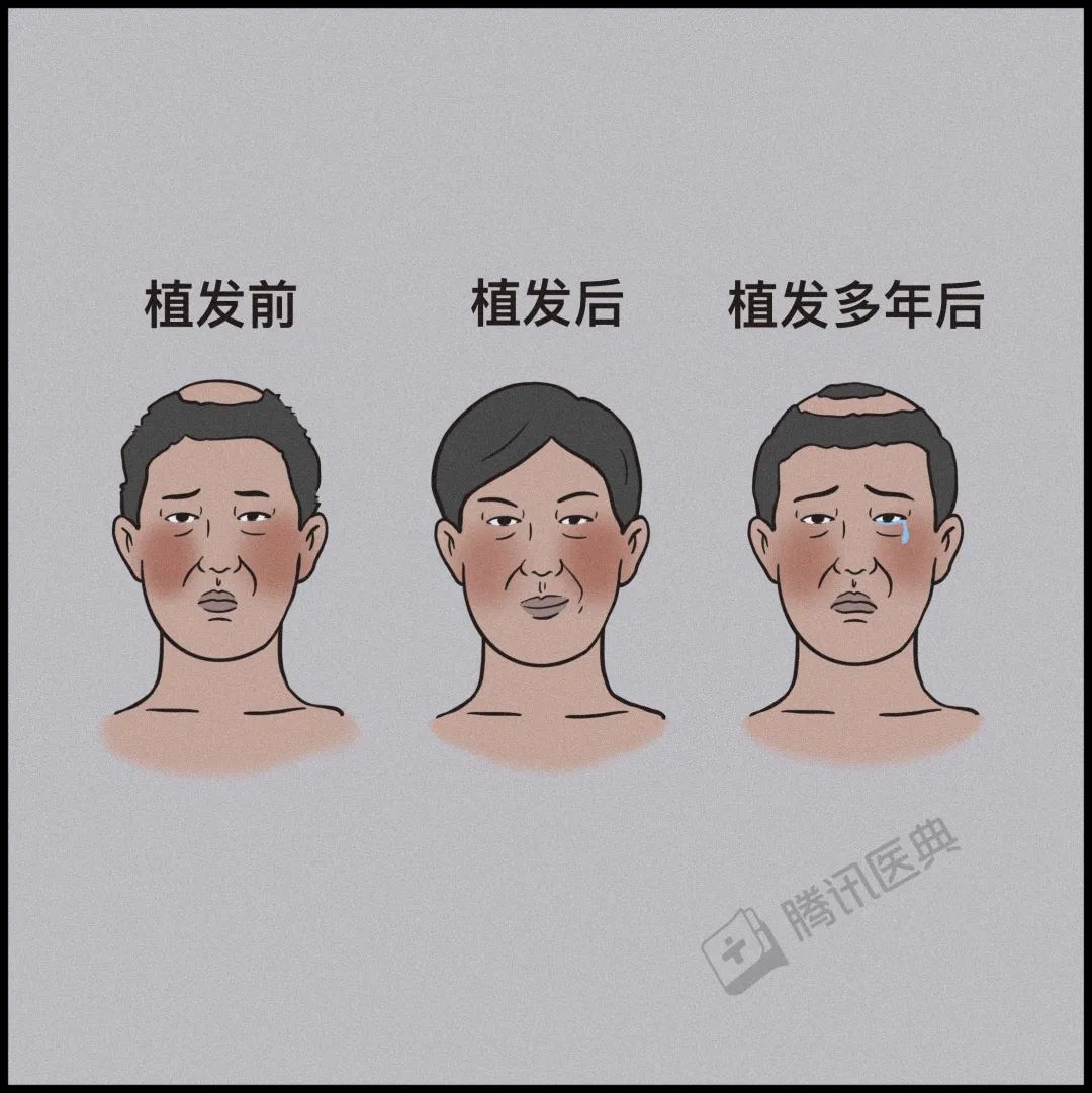 激光疗法有什么作用一篇帮人类打败脱发的文章（转给身边的他和她）_https://www.jmylbn.com_新闻资讯_第25张