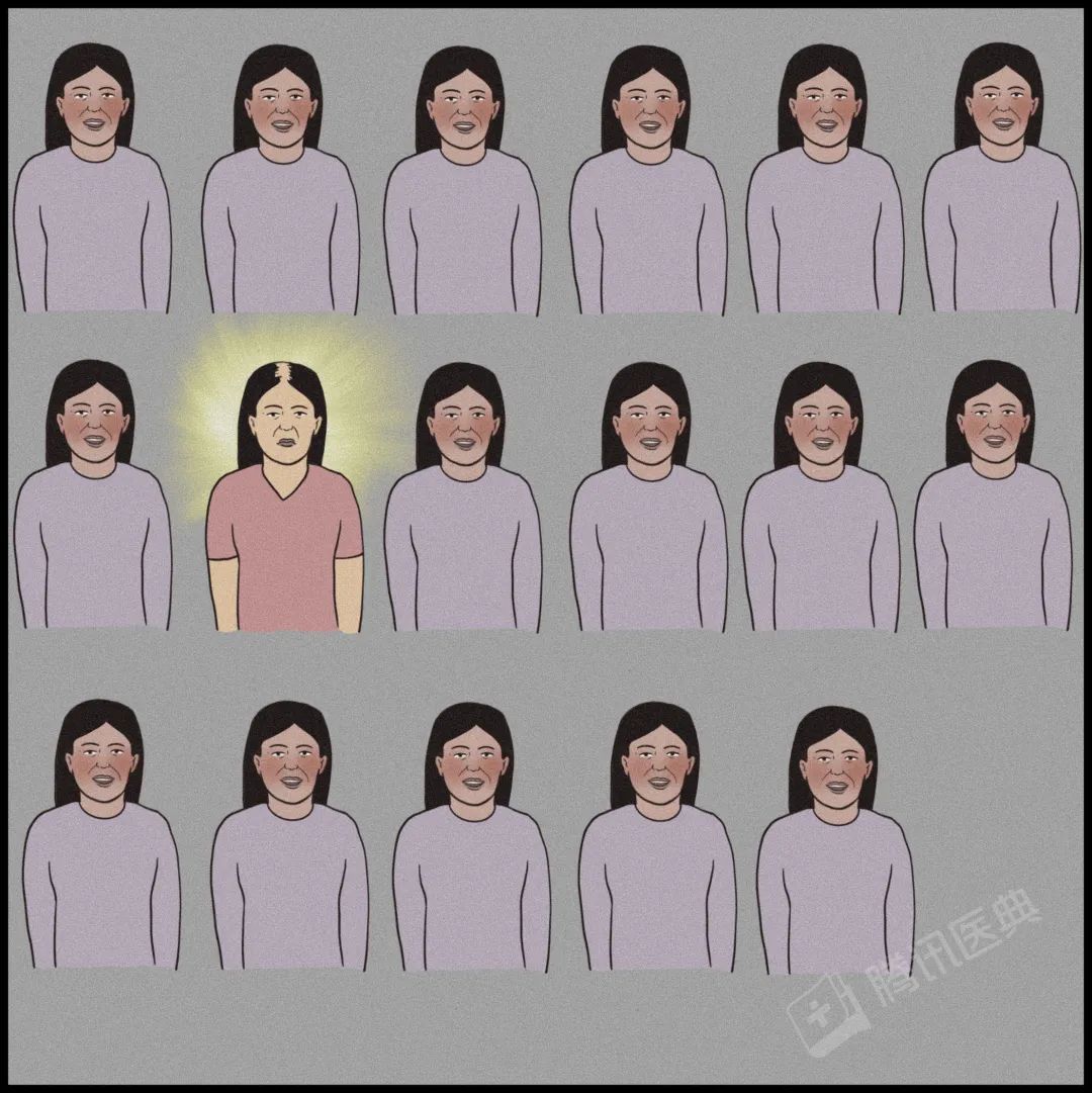 激光疗法有什么作用一篇帮人类打败脱发的文章（转给身边的他和她）_https://www.jmylbn.com_新闻资讯_第8张