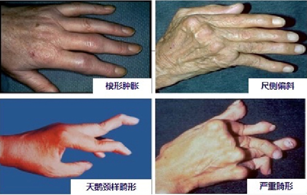 松江区中心医院风湿免疫门诊搬家啦门诊时间有调整