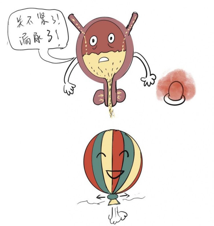 压力治疗是什么浦东医生话养生 ｜ 什么是压力性尿失禁？怎么预防和治疗？医生科普来啦！_https://www.jmylbn.com_新闻资讯_第3张