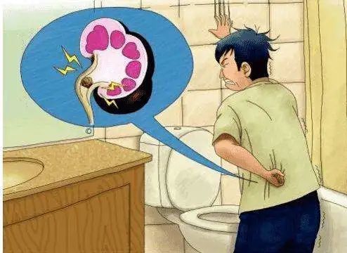 干货痛起来要人命的结石可以这样排