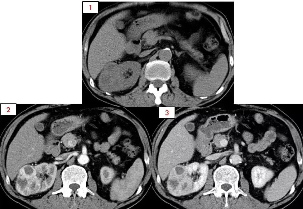 手机怎么拍摄x射线疾控话健康｜X光、CT、B超、磁共振，你搞清楚了吗？_https://www.jmylbn.com_新闻资讯_第10张