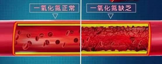 这5根血管最易堵，轻则致病，重则要命！(图12)