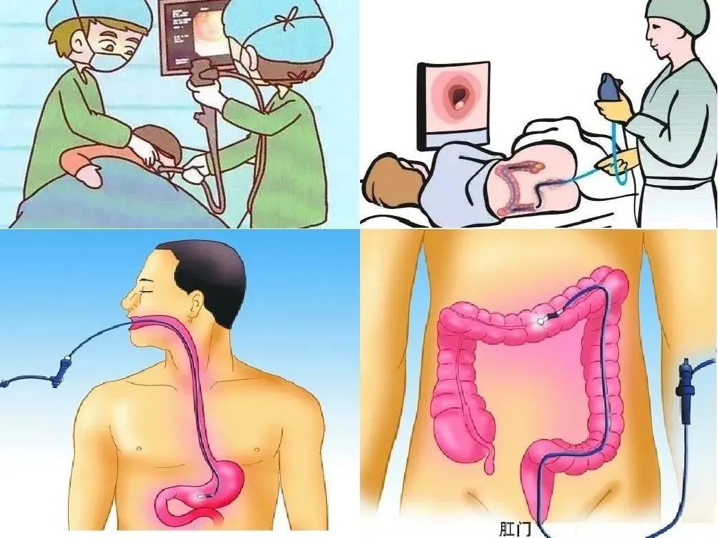 胃肠镜都有什么品牌【服务体验⑨】不用再怕麻烦，“一站式特约胃肠镜服务”来了！_https://www.jmylbn.com_新闻资讯_第3张