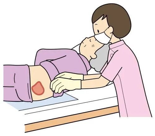 去腐生肌泗泾医院解除老人压疮之苦