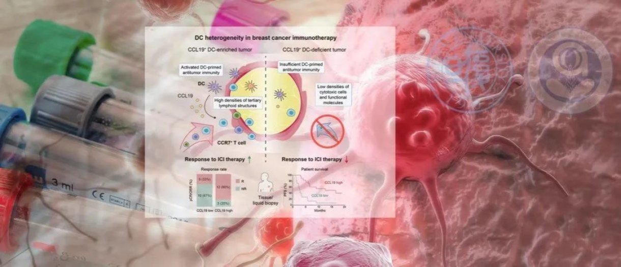 关注三阴性乳腺癌精准免疫治疗研究有新进展