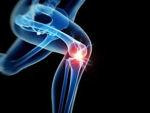 如何应对膝骨关节炎松江医生有妙招丨健康智慧屋