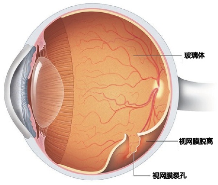 我的位置:>上观号>上海黄浦>文章详情>在视网膜的周边部位,玻璃体与