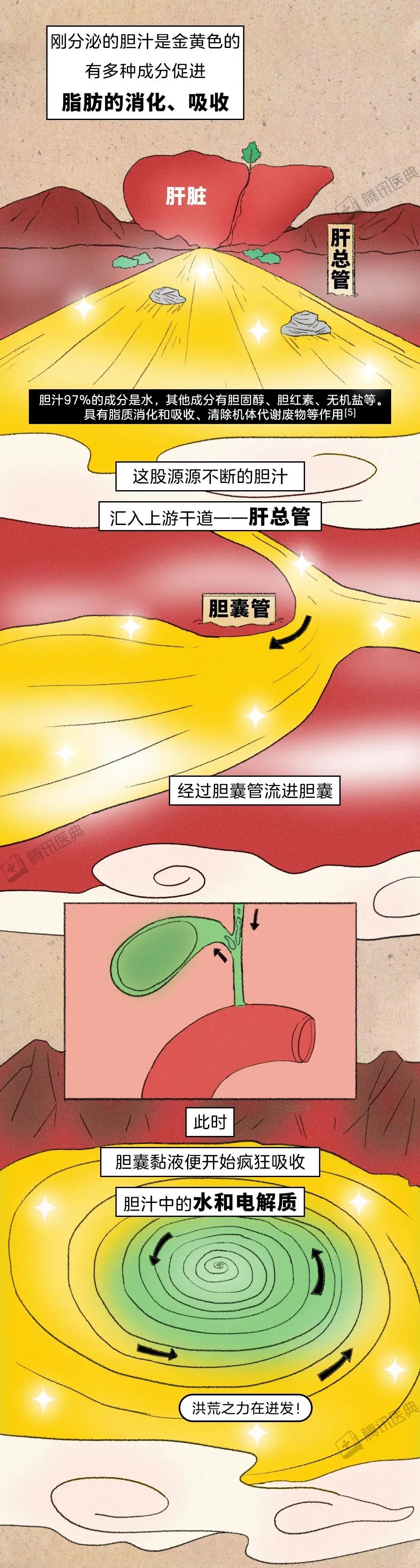 胆结石最爱找上2类人,记住5点可避开