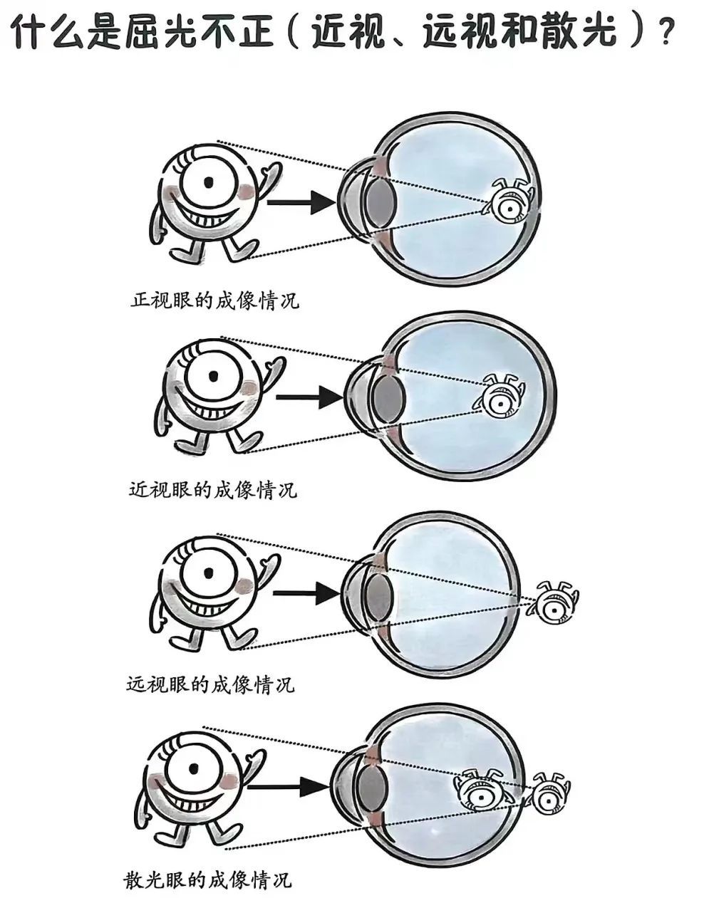 看不清黑板就是近视吗不一定贤医健康说