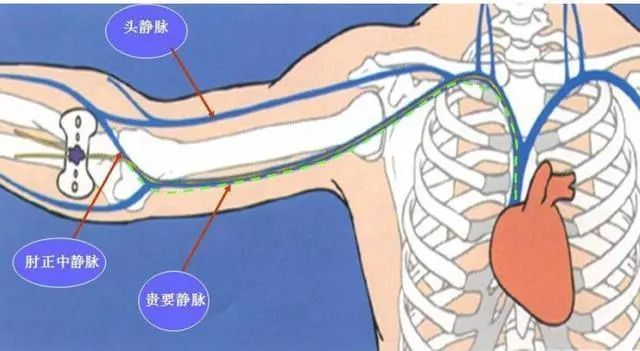 picc肱静脉解剖图图片