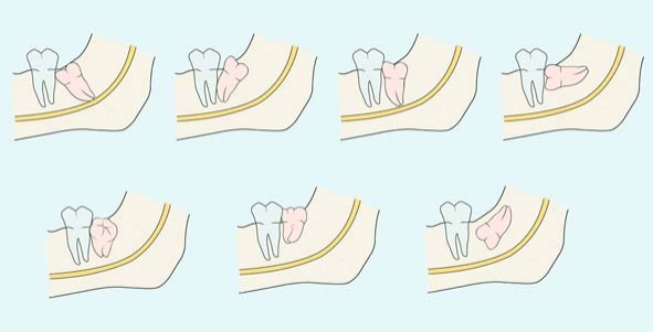 拥有德国kawa牙科综合治疗台,口腔ct,口腔全景机,口腔种植机,超声骨刀