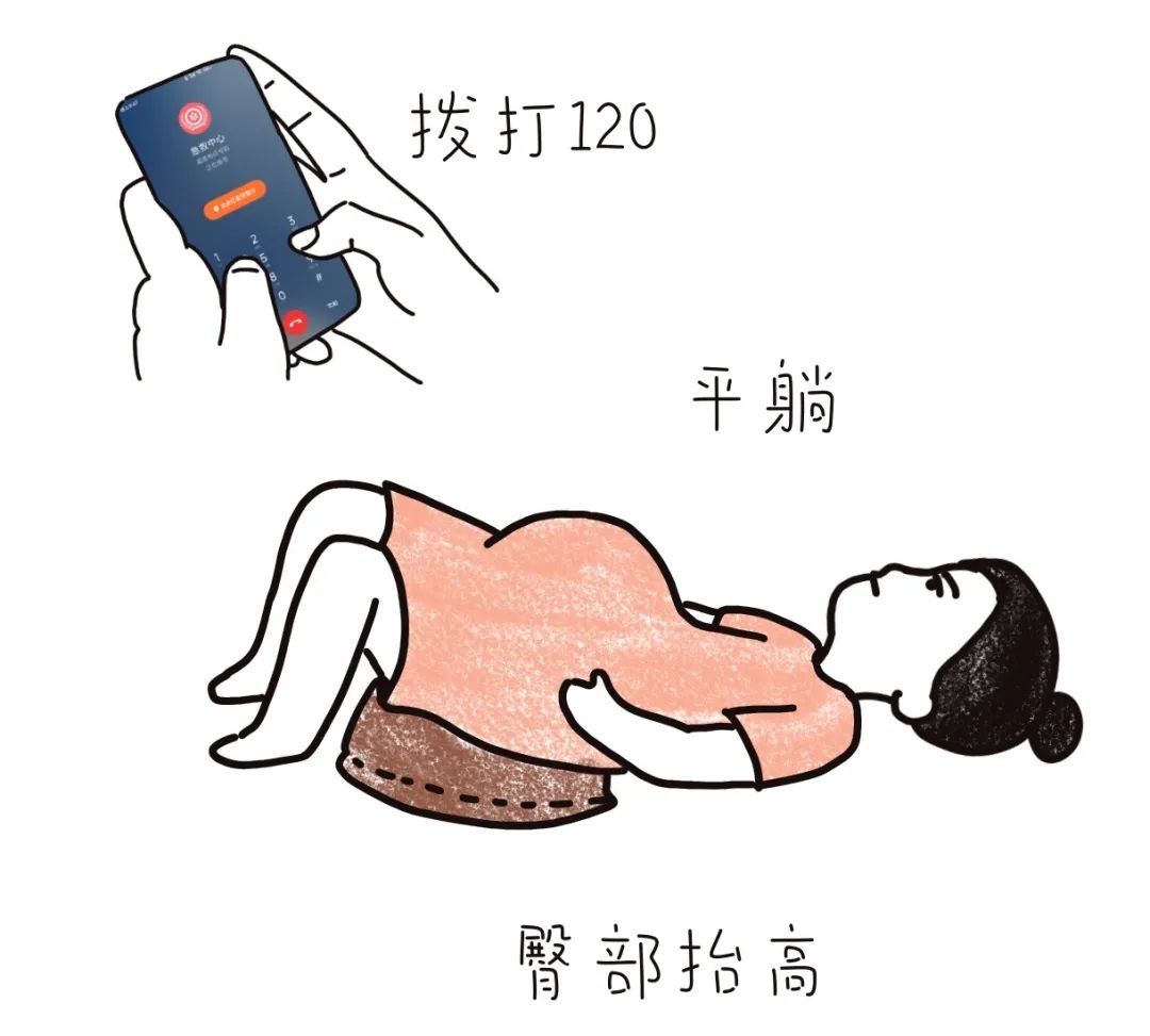 关爱孕妇警惕胎膜早破