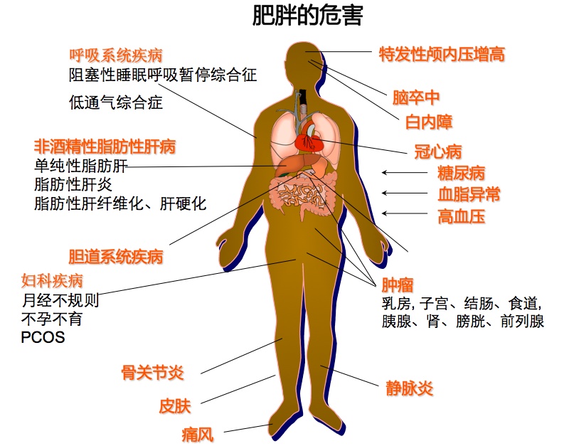 科普先锋一胖毁所有肥胖危害知多少