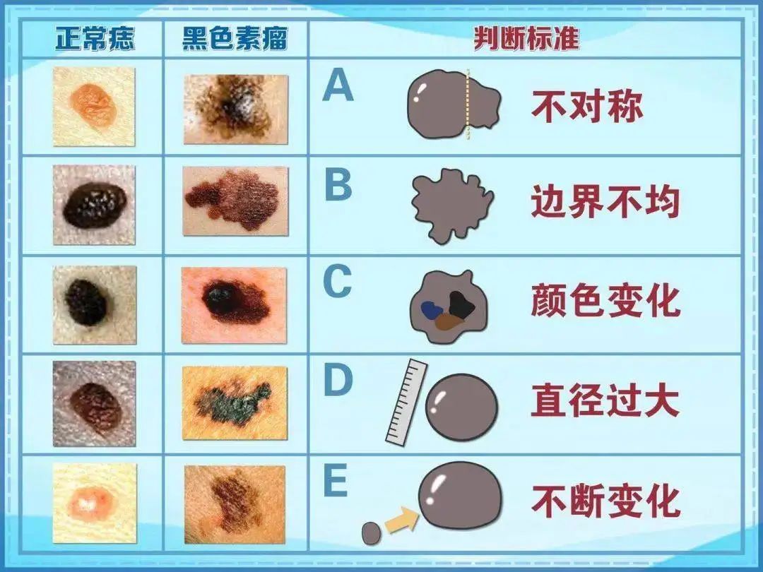 上观号 上海奉贤 文章详情 提示 如出现以上疑似痣变的可能