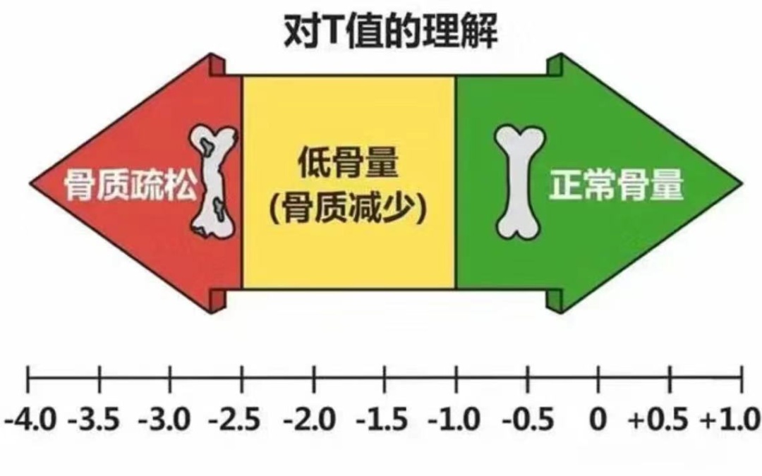 识别骨质疏松症