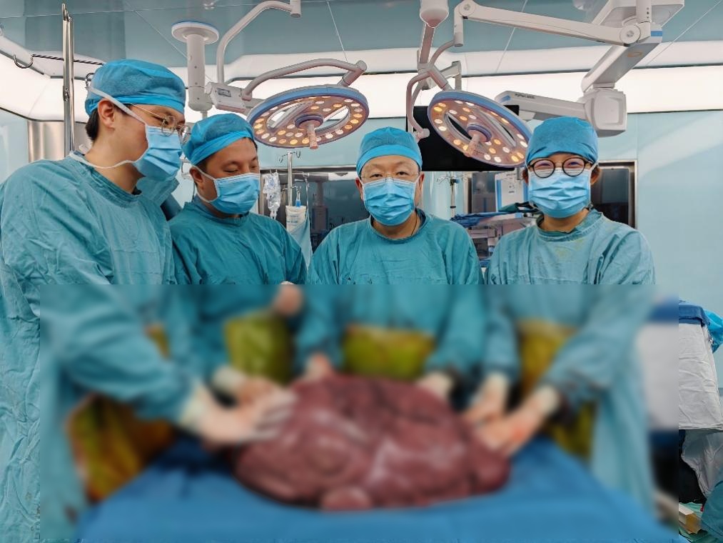 据悉,2009年,在普外科秦新裕教授,孙益红教授和陆维祺教授的带领下