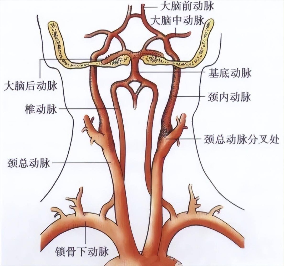 胚胎型大脑后动脉图片图片