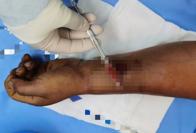 手术剪刀怎么卖惊呆！男子拆快递时切断大动脉，鲜血直喷！还有人拆完腹痛腹泻、眼红发痒..._https://www.jmylbn.com_新闻资讯_第2张