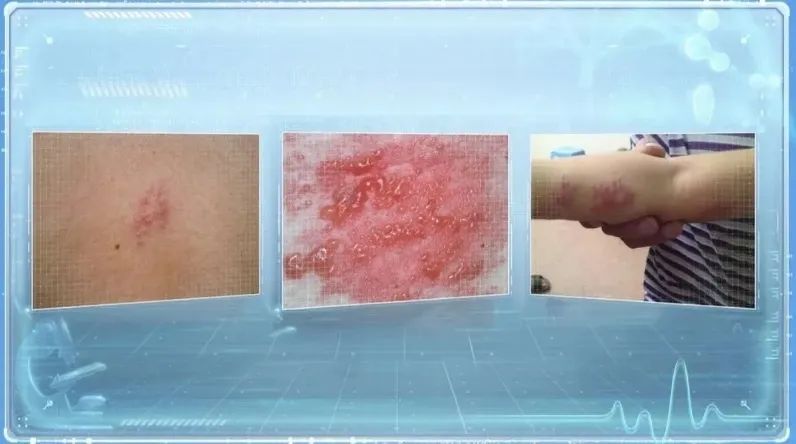 手术剪刀怎么卖惊呆！男子拆快递时切断大动脉，鲜血直喷！还有人拆完腹痛腹泻、眼红发痒..._https://www.jmylbn.com_新闻资讯_第3张